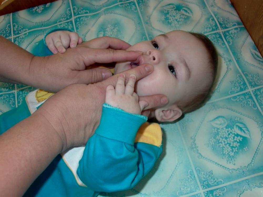 Логопедический массаж малышам. Логопедический массаж для новорожденных. Логопедический массаж новорожденному. Логопедический массаж губ. Домашний логопедический массаж